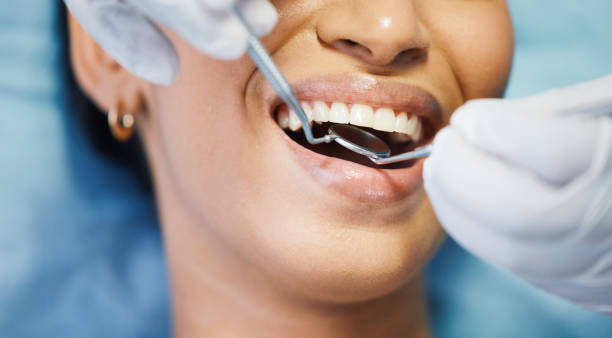 Best Urgent Care for Lost Fillings or Crowns in Bethany, WV